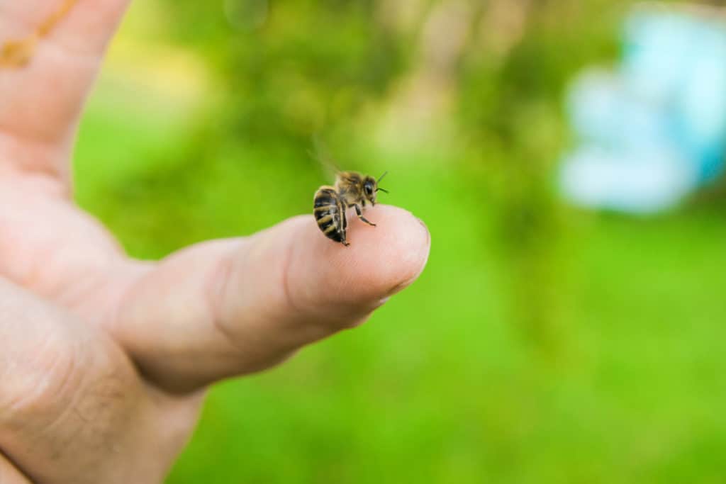 bee-stinging-hand
