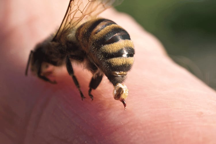 Bee sting man's hand, closeup